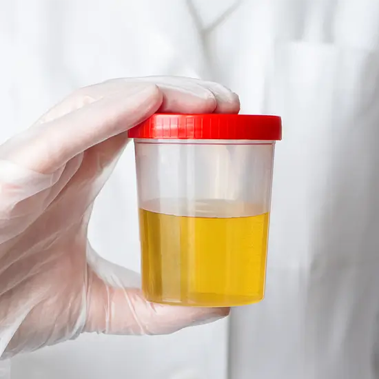 selenium, random urine test